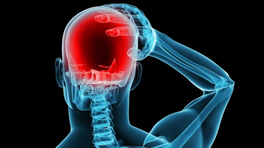 migraine-osteopathe